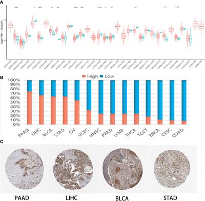 Prognostic Implications of Pan-Cancer CMTM6 Expression and Its Relationship with the Immune Microenvironment